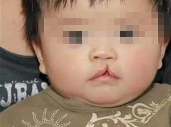 因家貧,媽故意把3歲「兔唇」女兒弄丟!20年後兩人街頭無意相遇「女兒現狀」卻令媽媽悔不當初:好想她