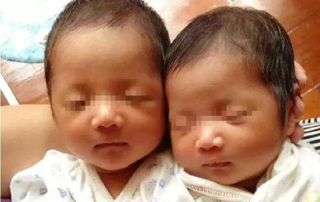 產婦艱難誕下「雙胞胎」,就在全家人歡呼高興時,醫生卻說:這可不是「雙胞胎 」